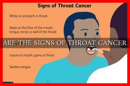 ARE THE SIGNS OF THROAT CANCER - Wadaef