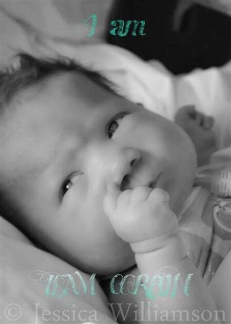 Born 7 weeks early Born 7 weeks early