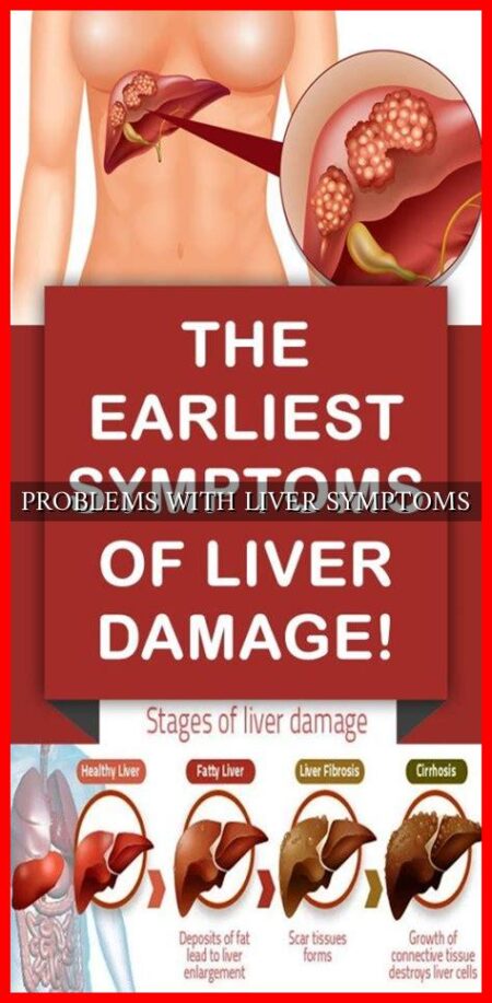 Problems With Liver Symptoms Wadaef 