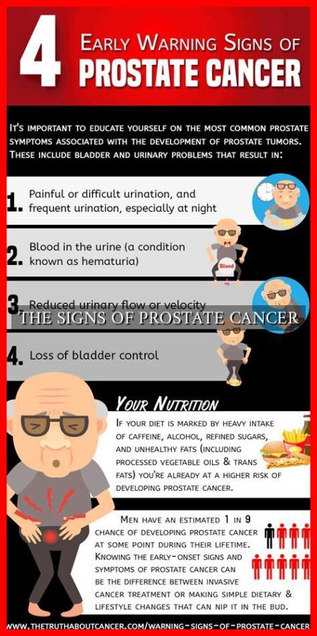 THE SIGNS OF PROSTATE CANCER - Wadaef