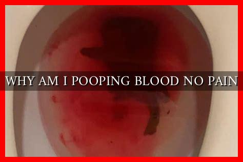 WHY AM I POOPING BLOOD NO PAIN WHY AM I POOPING BLOOD NO PAIN