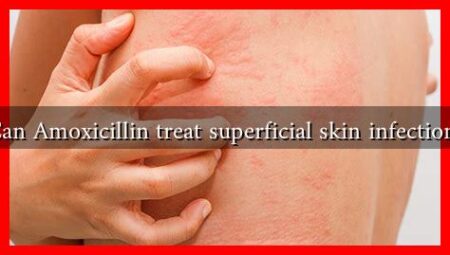 Can Amoxicillin treat superficial skin infections Can Amoxicillin treat superficial skin infections