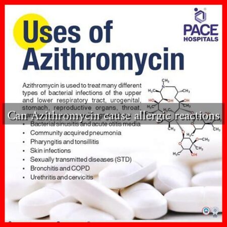 Can Azithromycin cause allergic reactions