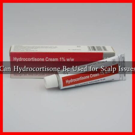 Can Hydrocortisone Be Used for Scalp Issues