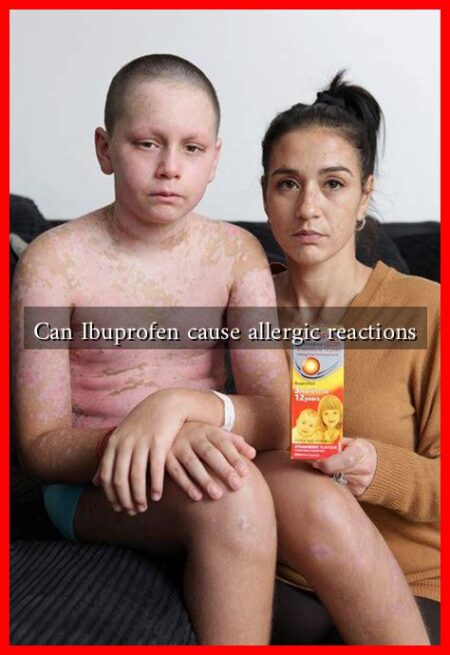Can Ibuprofen cause allergic reactions