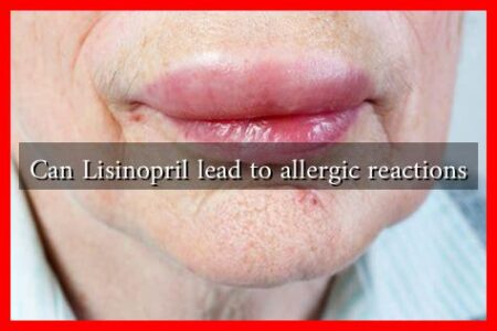 Can Lisinopril lead to allergic reactions