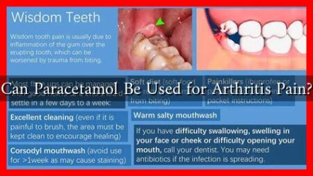 Can Paracetamol Be Used for Arthritis Pain? Can Paracetamol Be Used for Arthritis Pain?