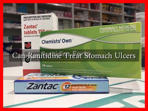 Can Ranitidine Treat Stomach Ulcers