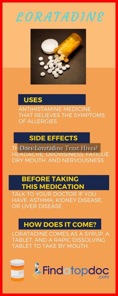 Does Loratadine Treat Hives?