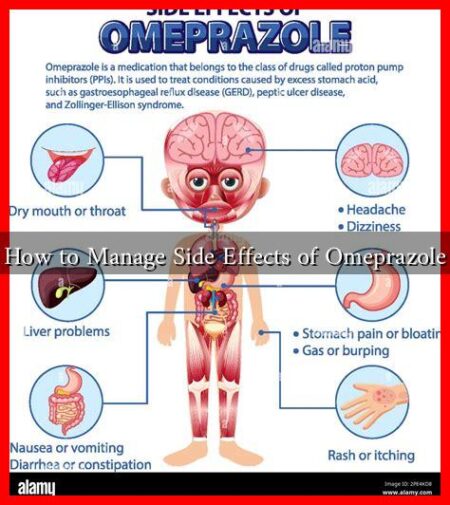 How to Manage Side Effects of Omeprazole