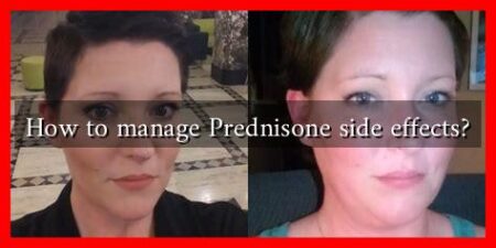 How to manage Prednisone side effects? How to manage Prednisone side effects?