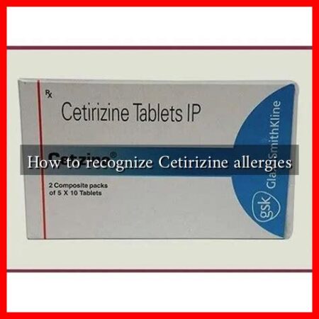 How to recognize Cetirizine allergies