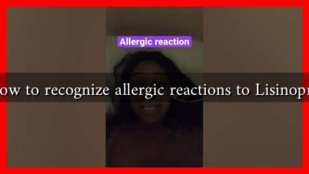 How to recognize allergic reactions to Lisinopril