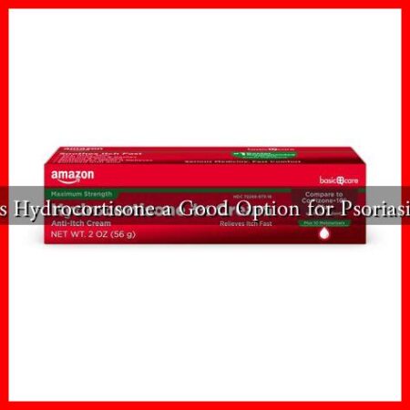 Is Hydrocortisone a Good Option for Psoriasis