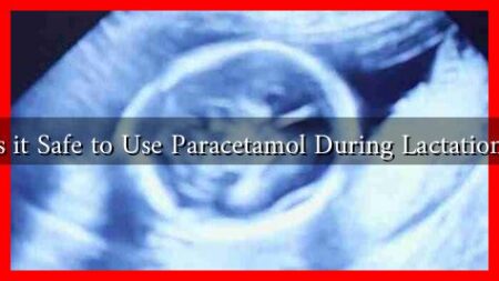 Is it Safe to Use Paracetamol During Lactation? Is it Safe to Use Paracetamol During Lactation?