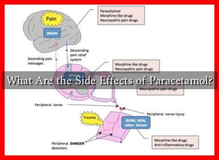 What Are the Side Effects of Paracetamol?