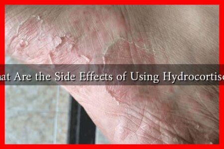 What Are the Side Effects of Using Hydrocortisone