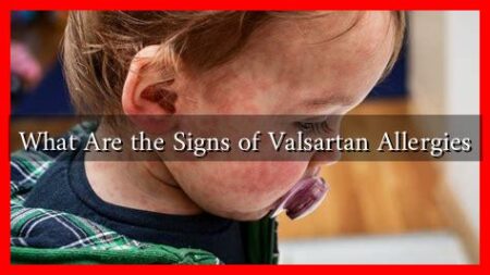What Are the Signs of Valsartan Allergies