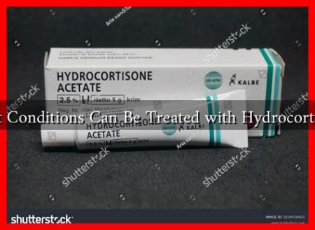 What Conditions Can Be Treated with Hydrocortisone