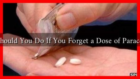 What Should You Do If You Forget a Dose of Paracetamol?