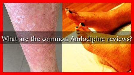 What are the common Amlodipine reviews?