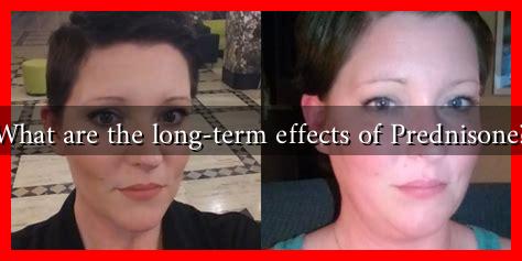 What are the long-term effects of Prednisone?