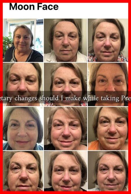 What dietary changes should I make while taking Prednisone?