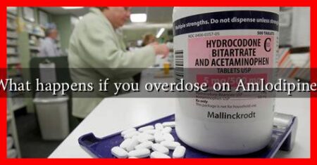 What happens if you overdose on Amlodipine?
