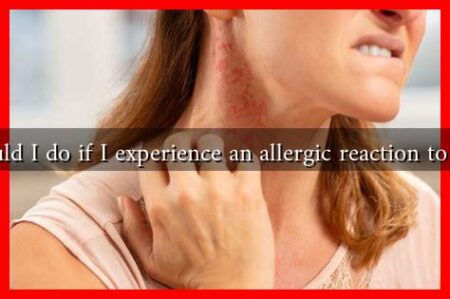 What should I do if I experience an allergic reaction to Glipizide?