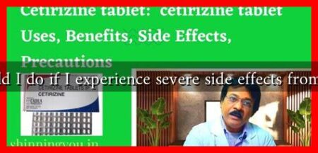 What should I do if I experience severe side effects from Cetirizine
