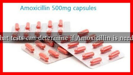 What tests can determine if Amoxicillin is needed