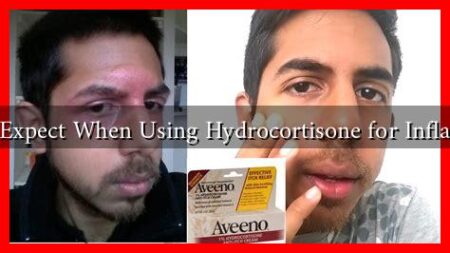 What to Expect When Using Hydrocortisone for Inflammation What to Expect When Using Hydrocortisone for Inflammation