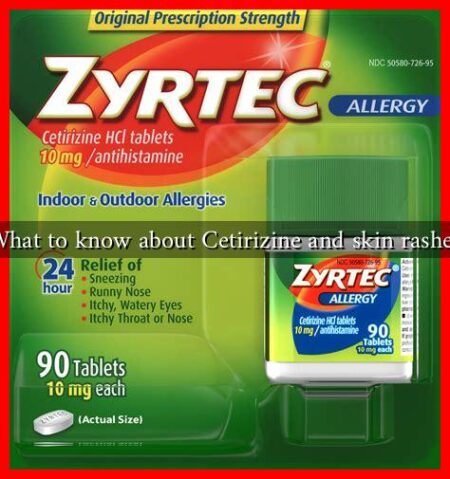 What to know about Cetirizine and skin rashes What to know about Cetirizine and skin rashes